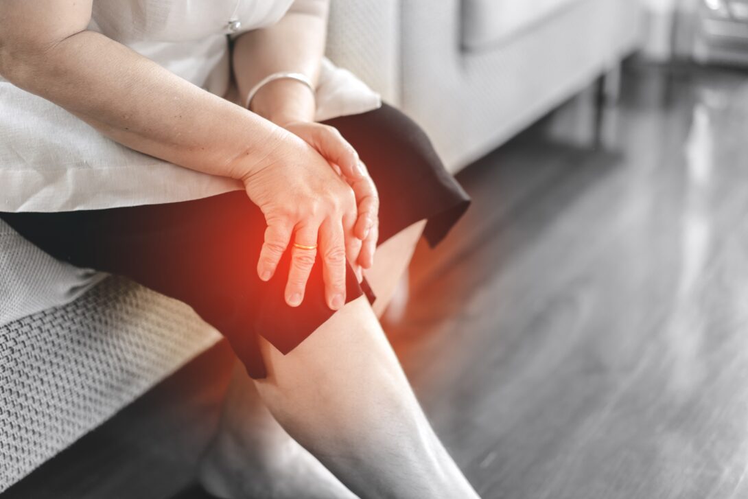 Woman with osteoarthritis in her knee